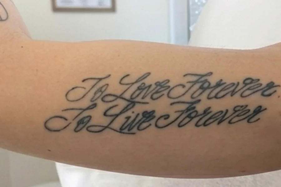 Tatuagem corporal antes da remoção a laser